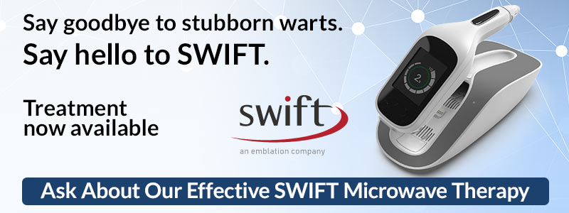 SWIFT for Plantar Warts